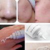 kem-tri-mun-la-roche-posay-effaclar-duo