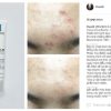 kem-tri-mun-la-roche-posay-effaclar-duo