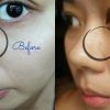 kem-tri-mun-la-roche-posay-effaclar-duo