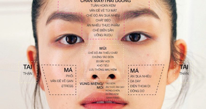 face-mapping-nguyen-nhan-bi-mun-1