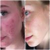 dung-dich-paulas-choice-skin-perfecting-2-bha-liquid-minisize-30-ml5
