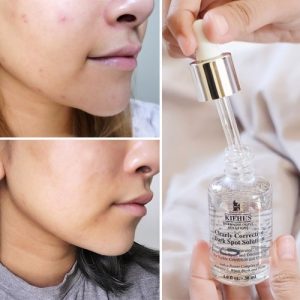 Serum Trị Thâm Kiehl's Dark Spot Solution 4ml