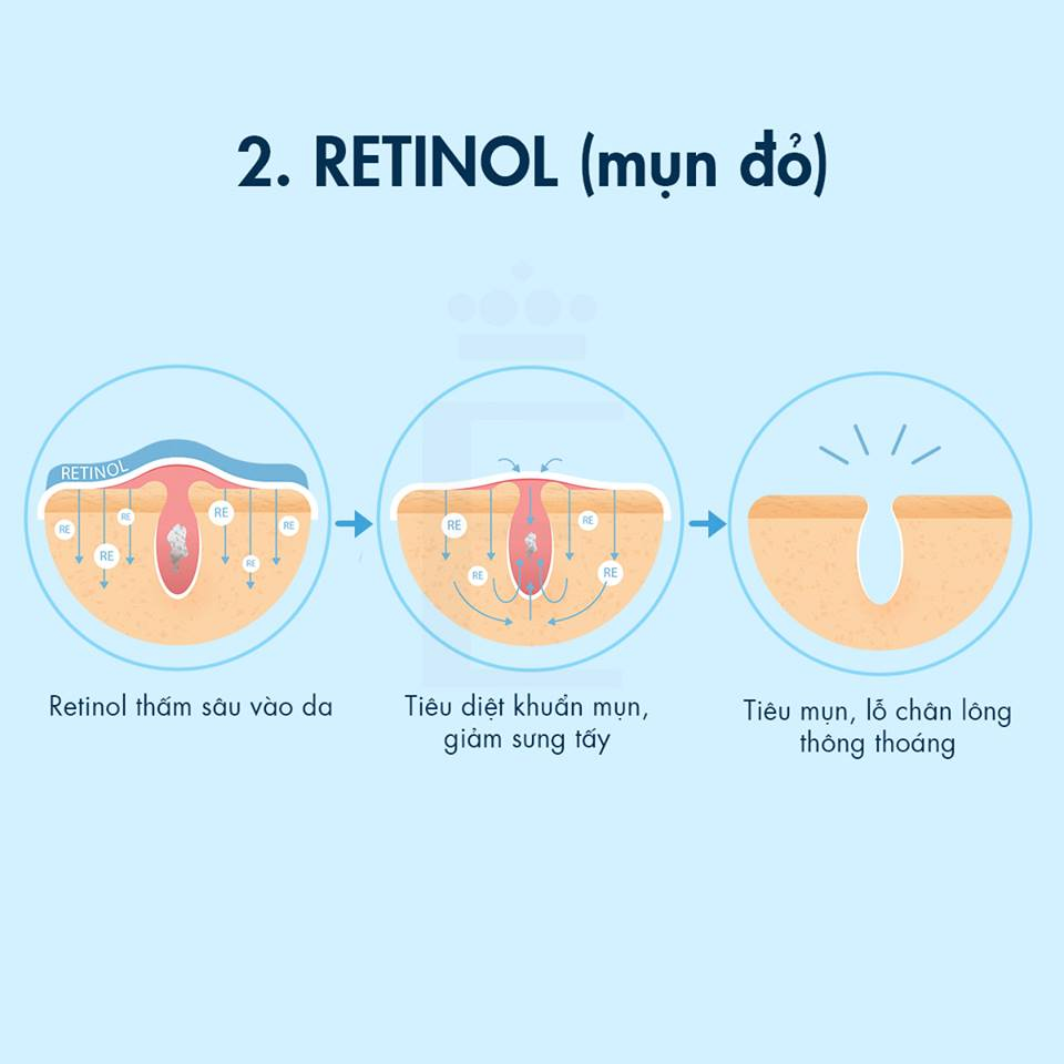 Khám Phá Cơ Chế Hoạt Động Của 8 Hoạt Chất Trị Mụn