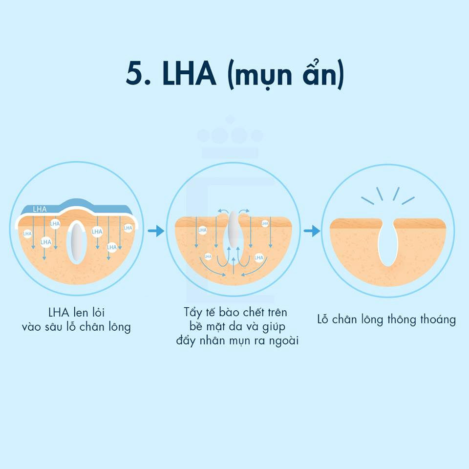 Khám Phá Cơ Chế Hoạt Động Của 8 Hoạt Chất Trị Mụn