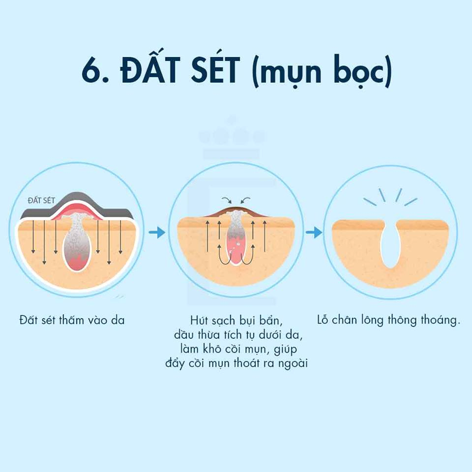 Khám Phá Cơ Chế Hoạt Động Của 8 Hoạt Chất Trị Mụn