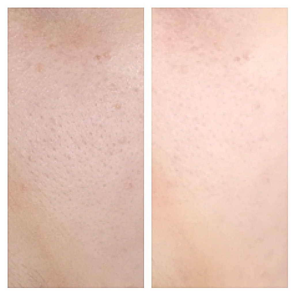 Serum Estee Lauder Idealist Pore Minimizing Skin Refinisher 30ml serum-estee-lauder-idealist-1