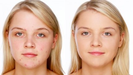 5 Điều Thú Vị Về Che Khuyết Điểm Mà Có Thể Các Nàng Chưa Biết