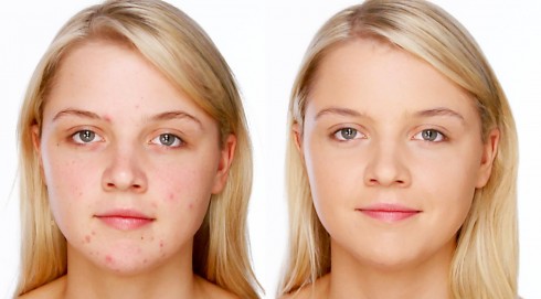 5 Điều Thú Vị Về Che Khuyết Điểm Mà Có Thể Các Nàng Chưa Biết