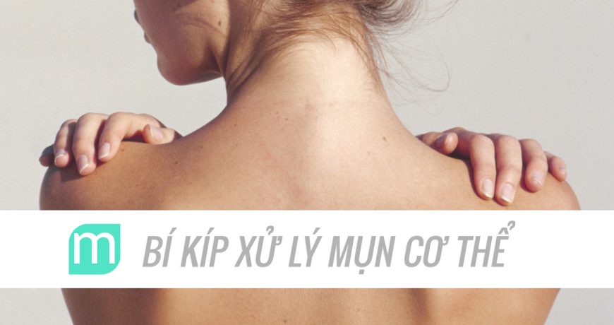 Bí Kíp Xử Lí Triệt Để Mụn Cho Cơ Thể bi-kip-xu-li-triet-de-mun-cho-co-the