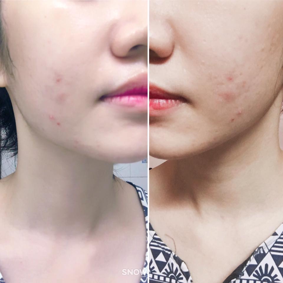 mat-na-y-di-naruko-jobs-tear-pore-minimizing-brightening-mask