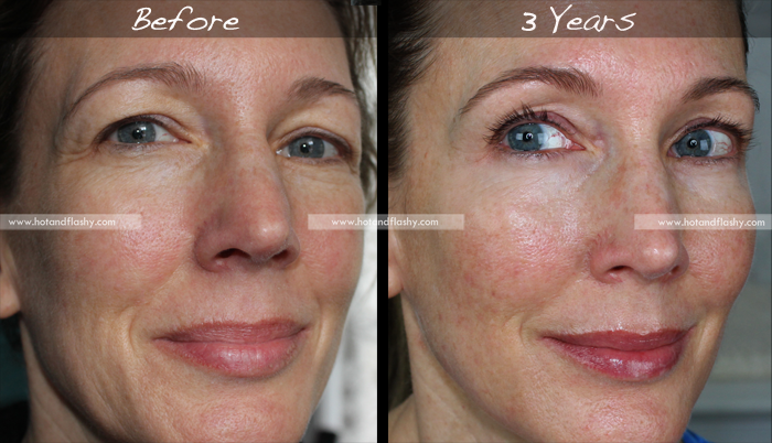 Retinol Và 5 Sự Thật Ai Cũng Nhầm Tưởng retinol-va-5-su-that-ai-cung-lam-tuong