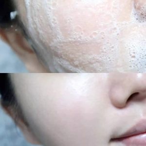 Sữa Rửa Mặt Avene Cleanance Cleansing Gel