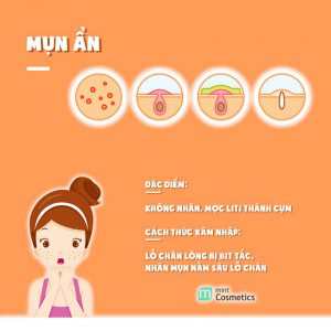ban-da-thuc-su-hieu-mun-cua-ban