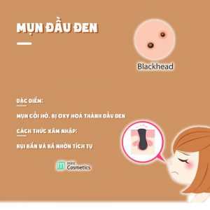 ban-da-thuc-su-hieu-mun-cua-ban