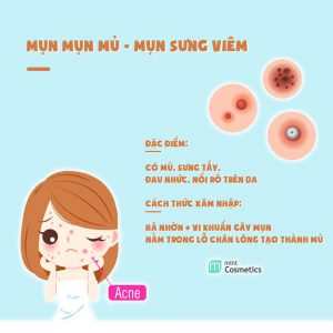 ban-da-thuc-su-hieu-mun-cua-ban