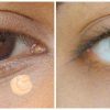 che-khuyet-diem-loreal-true-match-concealer