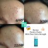 dung-dich-paulas-choice-bha-extra-strength-anti-redness-bha-2-30ml dung-dich-paulas-choice-bha-extra-strength-anti-redness-bha-2-30ml