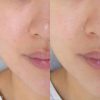 mat-na-naruko-rose-astringent mat-na-naruko-rose-astringent