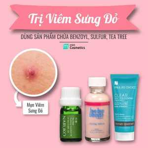 tong-hop-san-pham-tri-mun-tai-mint-cosmetics-2