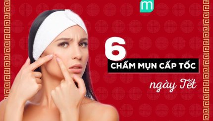 6 Chấm Mụn Cấp Tốc Phải Thủ Sẵn Ngày Tết 6-cham-mun-cap-toc-phai-thu-san-ngay-tet