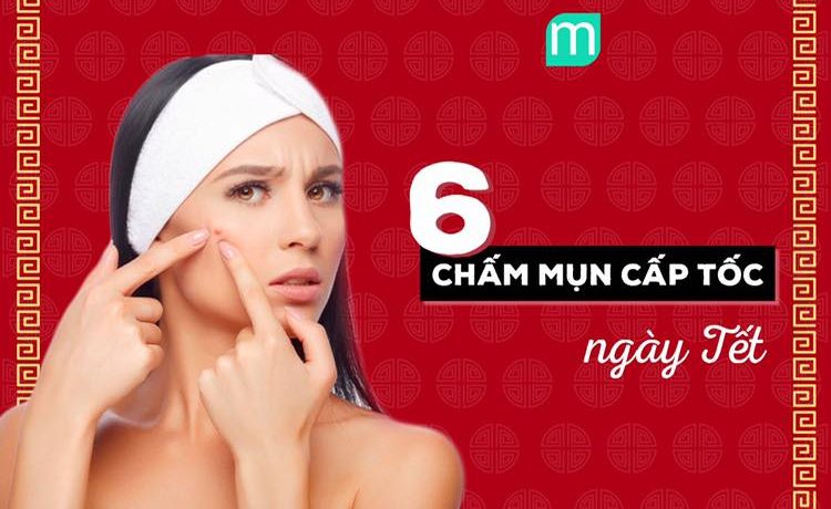 6-cham-mun-cap-toc-phai-thu-san-ngay-tet
