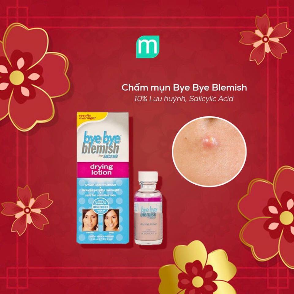 6-cham-mun-cap-toc-phai-thu-san-ngay-tet