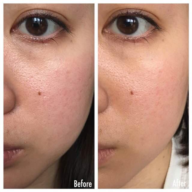 serum-naruko-raw-jobs-tears-30ml