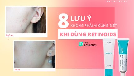 8-luu-y-khong-phai-ai-cung-biet-khi-dung-retinoid