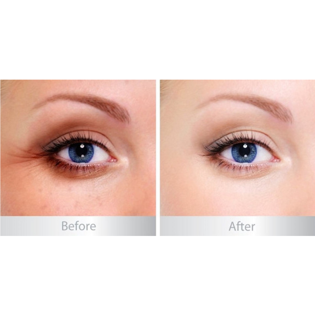 Kem Mắt Balance Gold + Marine Collagen Rejuvenating Eye Serum 15ml Kem Mắt Balance Gold + Marine Collagen Rejuvenating Eye Serum 15ml - Ảnh 4