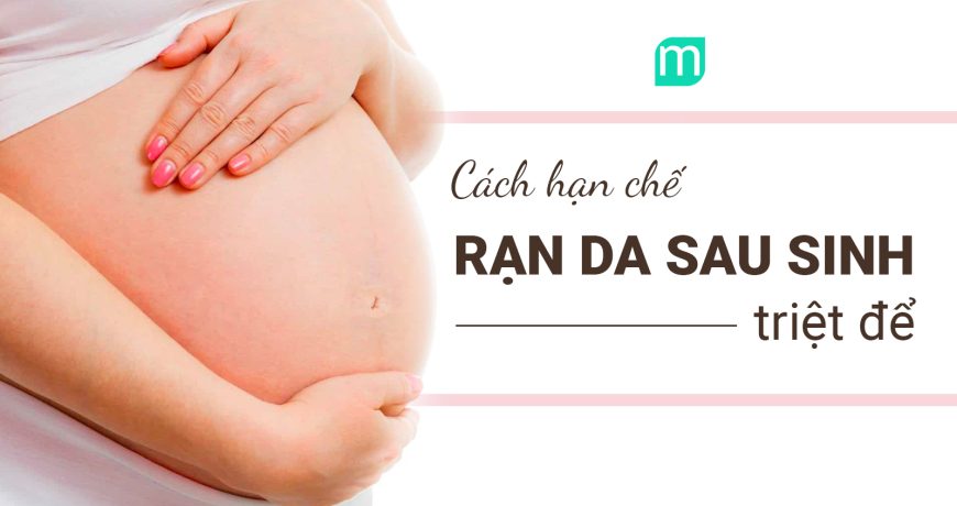 Chấm Dứt Nỗi Lo Rạn Da Sau Sinh Của Các Mẹ Bỉm Sữa