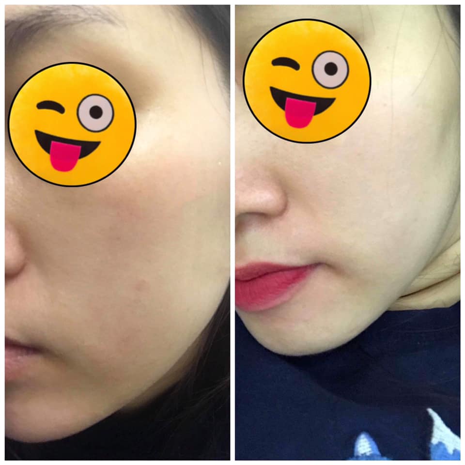 review-vien-uong-trang-da-helio-care