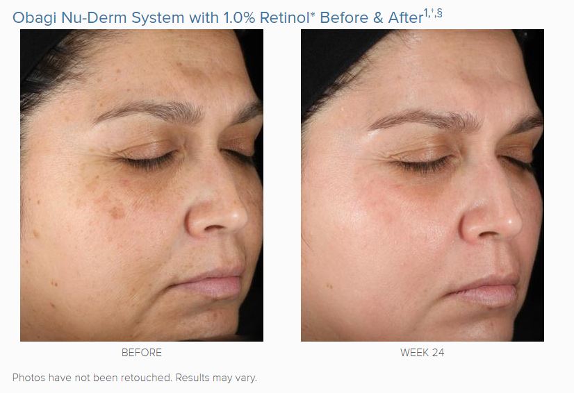 treatment-obagi360-retinol-1-0