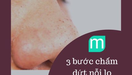 3-buoc-cham-dut-noi-lo-mun-dau-den