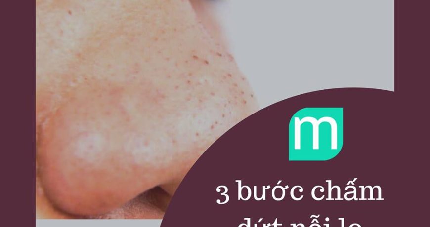 3-buoc-cham-dut-noi-lo-mun-dau-den