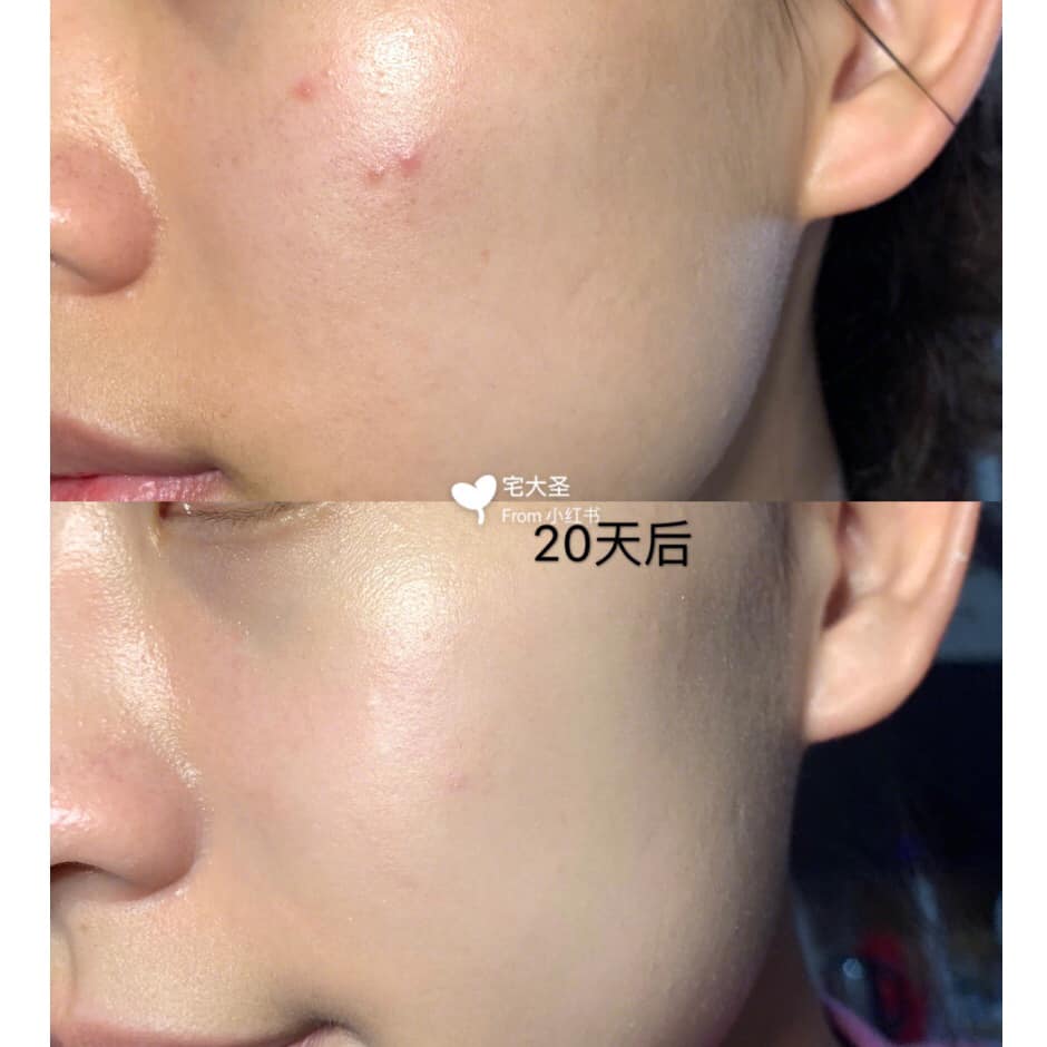 Kem Dưỡng Some By Mi AHA-BHA-PHA Miracle Cream 30 Days kem-duong-some-by-mi-aha-bha-pha-miracle-cream-30-days