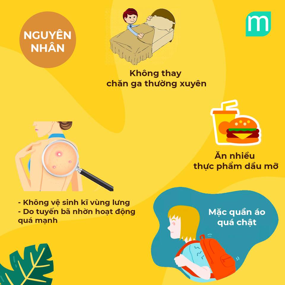 nguyen-nhan-va-giai-phap-tri-mun-lung