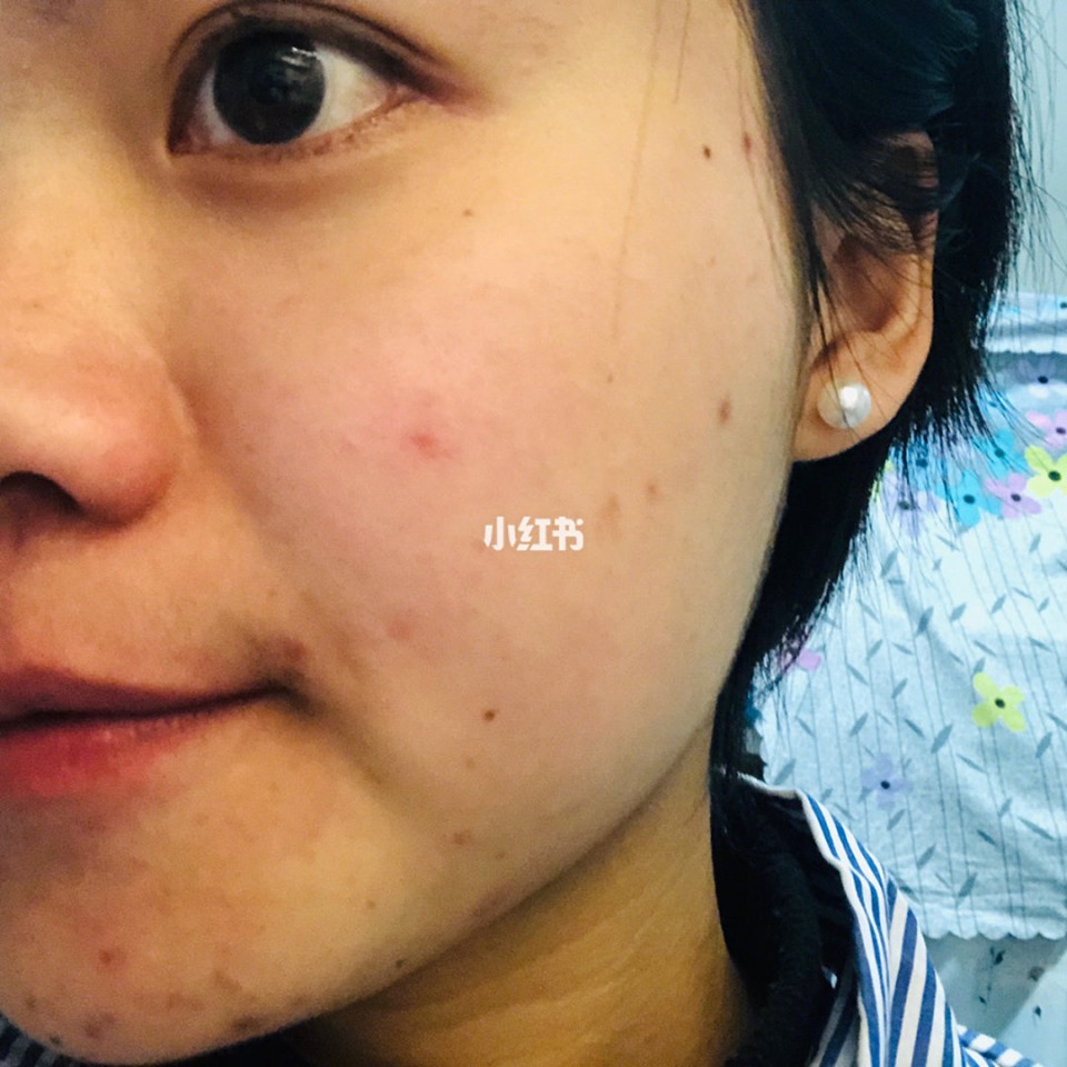 Review Nước Hoa Hồng Laroche Posay Effaclar review-nuoc-hoa-hong-laroche-posay-effaclar