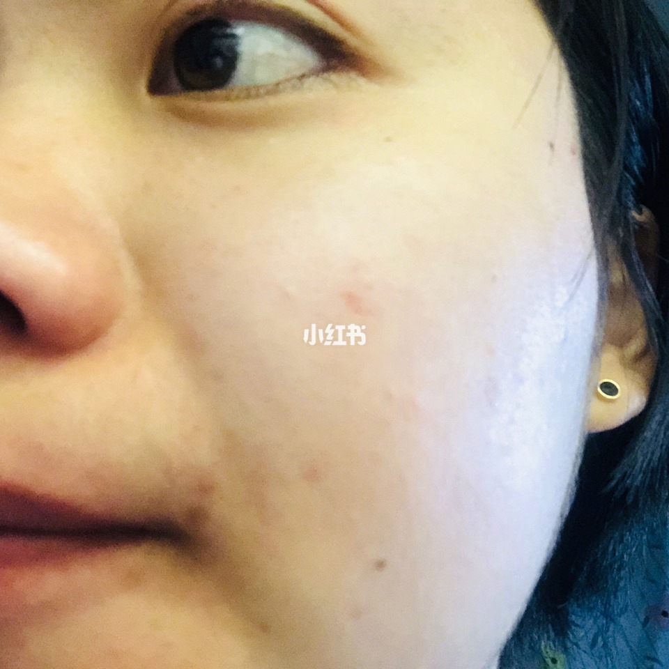 Review Nước Hoa Hồng Laroche Posay Effaclar review-nuoc-hoa-hong-laroche-posay-effaclar