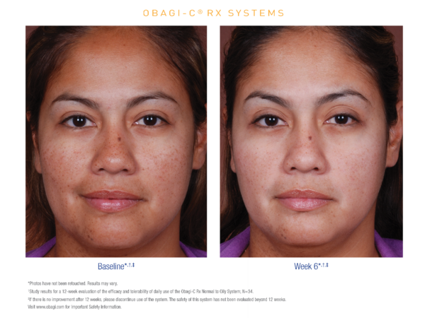 serum-obagi-rx-c-clarifying