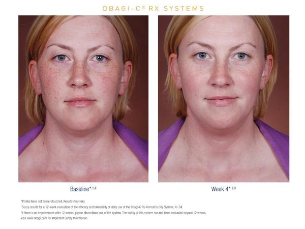 serum-obagi-rx-c-clarifying