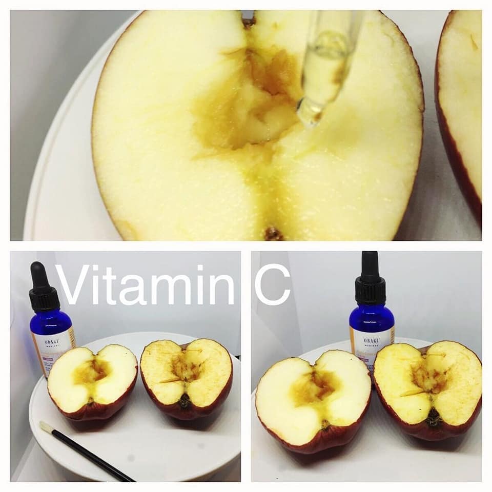 serum-vitamin-c-nao-cua-obagi-danh-cho-ban?