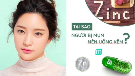 tai-sao-nguoi-bi-mun-nen-uong-kem