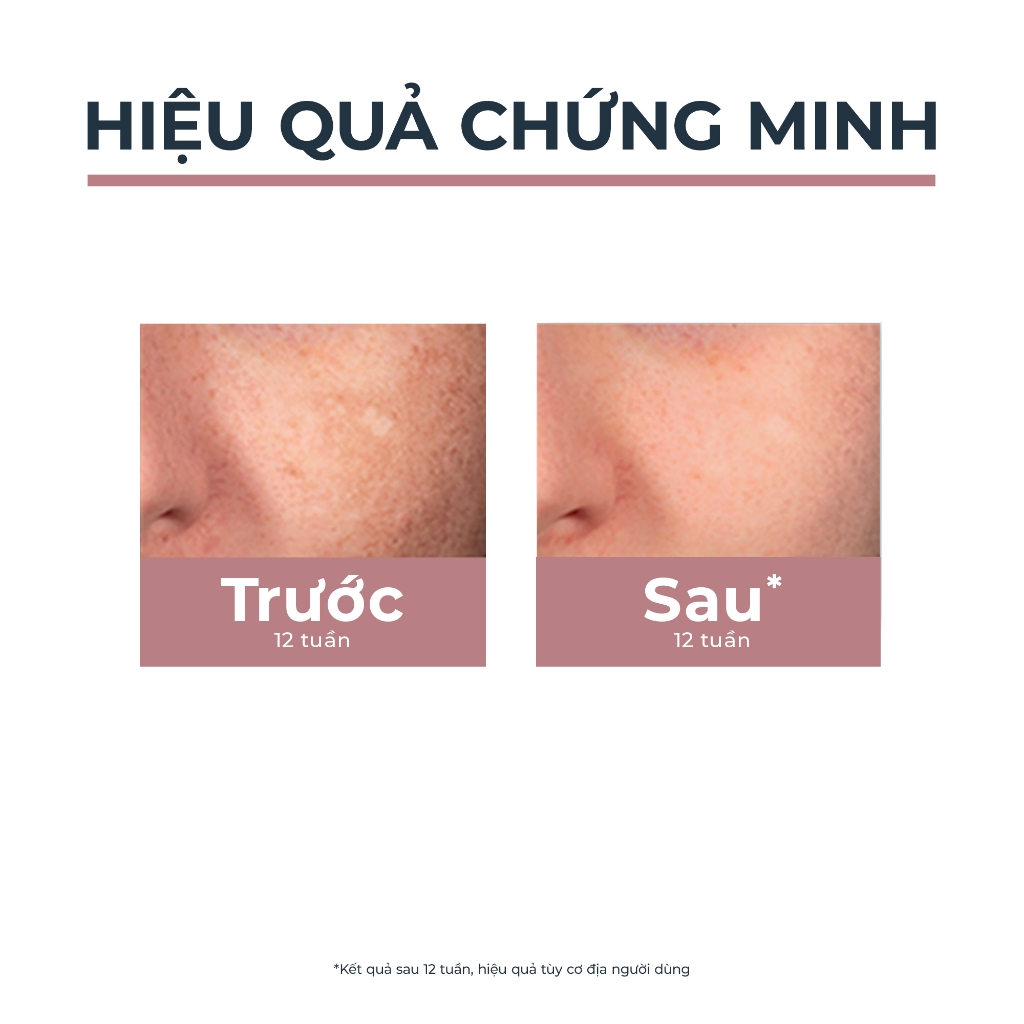 Bút Chấm Mờ Thâm Nám Eucerin Spotless Brightening Spot Corrector 5ml Bút Chấm Mờ Thâm Nám Eucerin Spotless Brightening Spot Corrector 5ml