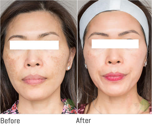 Kem Chống Nắng Eucerin Sun Serum Spotless Brightening SPF50 kem-chong-nang-eucerin-sun-serum-double-whitening-spf50