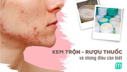 kem-tron-ruou-thuoc-va-nhung-dieu-can-biet