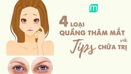4-loai-quang-tham-mat-va-tips-chua-tri