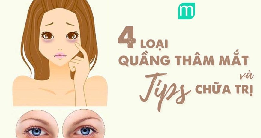 4-loai-quang-tham-mat-va-tips-chua-tri