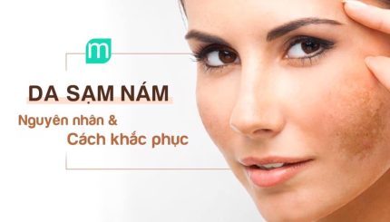da-sam-nam-nguyen-nhan-va-cach-khac-phuc