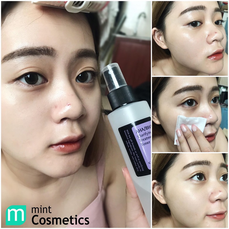 Review Nước Hoa Hồng Cosrx AHA/BHA Clarifying Treatment Toner review-nuoc-hoa-hong-cosrx-aha-bha-clarifying-treatment-toner