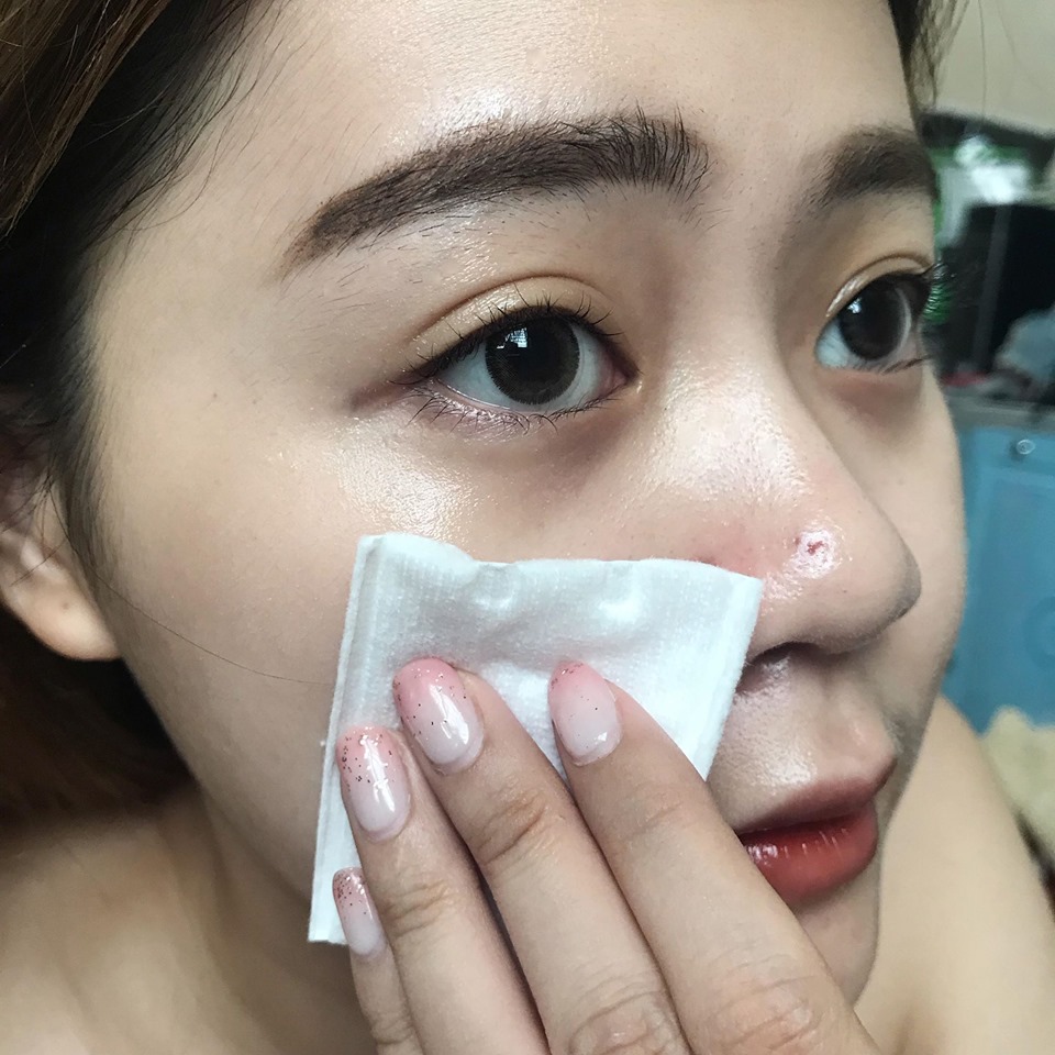 Review Nước Hoa Hồng Cosrx AHA/BHA Clarifying Treatment Toner review-nuoc-hoa-hong-cosrx-aha-bha-clarifying-treatment-toner